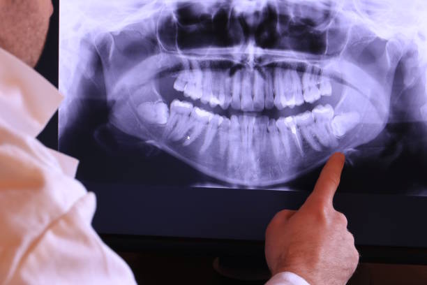 Best Emergency Treatment for Dental Infections or Abscesses in Holdrege, NE