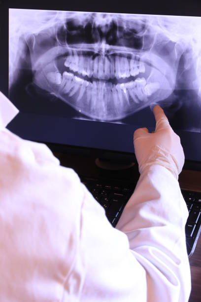 Best Emergency Wisdom Teeth Removal in Holdrege, NE