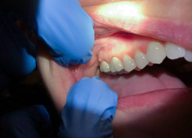 Best Emergency TMJ Treatment in Holdrege, NE
